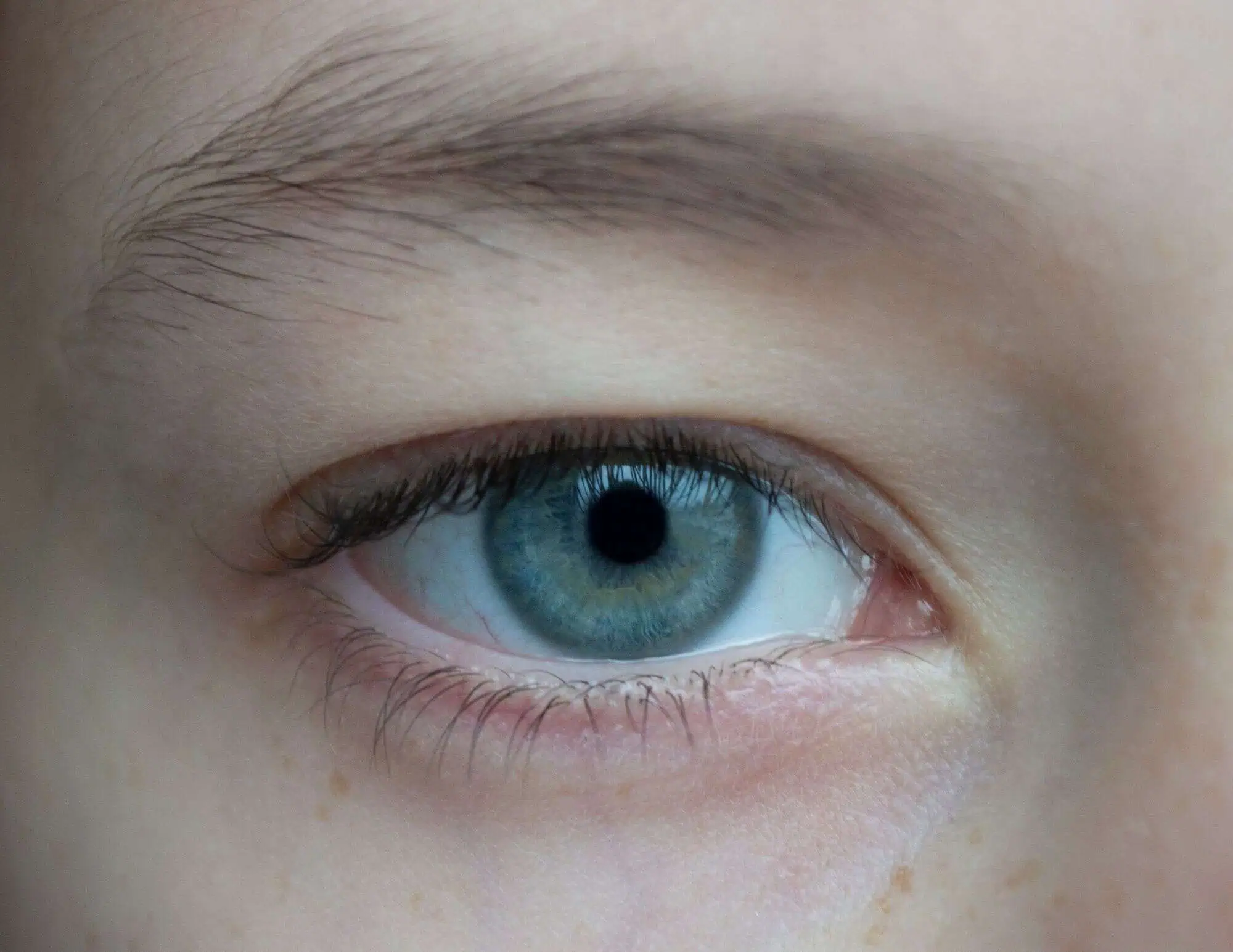 A closeup of an eye of a patient at Mango Optic in Boca Raton.